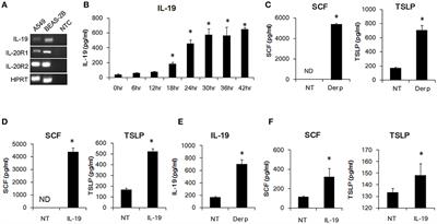 Blocking IL-19 Signaling Ameliorates Allergen-Induced Airway Inflammation